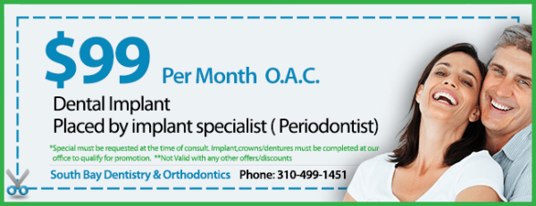 Coupon $99 per month  Implant Special O.A.C.